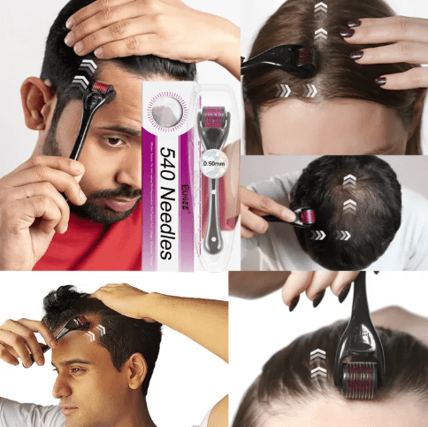 7 Days Hair Growth Serum with 540 Micro-Needle Derma Roller
